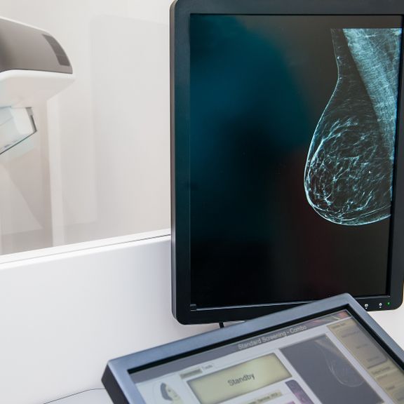 What Is The Importance Of A 3d Mammogram Duly Health And Care