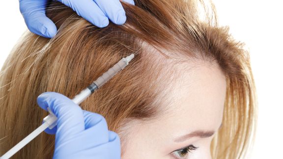 Restore Your Hair With PRP | Duly Health and Care - DuPage Medical Group